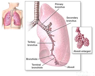 wrongful death, personal injury, lung disease, work injury, asbestos particles, natural fibers, industrial and household products, exposure to asbestos, mesothelioma, lung disease, lungs, abdomen, pleural mesothelioma, peritoneal mesothelioma, product liability